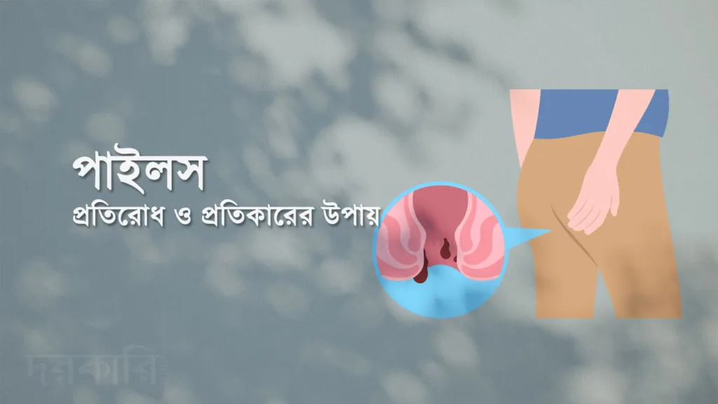 পাইলস প্রতিরোধ ও প্রতিকারের উপায়